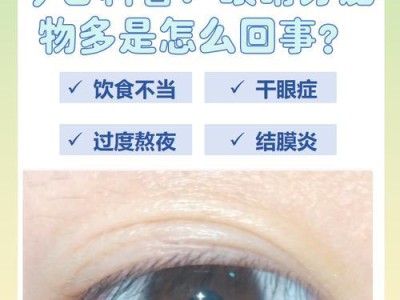 猫的眼屎形成过程及治疗方法（了解猫眼屎的产生原因以及处理方法）