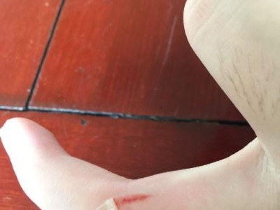 狗狗疫苗失效的后果及预防措施（狗狗疫苗失效可能导致疾病爆发，及时补种是关键）