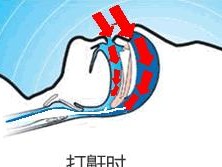贵宾为什么会打呼噜？（探究贵宾犬打呼噜的原因及应对方法）