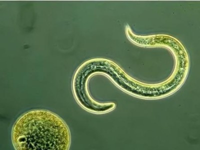 动物寄生虫的种类及危害（了解动物寄生虫，保护健康）