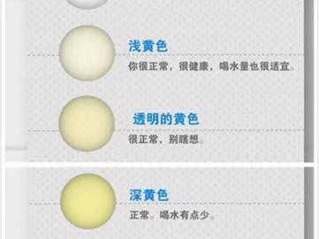 尿液颜色的变化与健康状况关系探析（尿液颜色的变化对身体健康的重要意义）