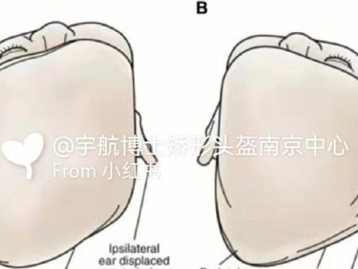 狭颅田鼠的宠物养护指南（以狭颅田鼠的饲养方法为主题，详解狭颅田鼠的日常养护）