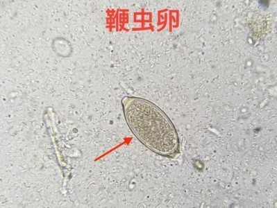 狗狗球虫（探秘狗狗球虫的形态与疾病危害，了解如何防治）