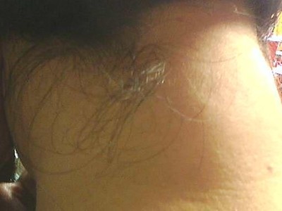 贵宾脖子有硬块的原因及解决方法（了解贵宾脖子硬块的成因以及有效的治疗方式）