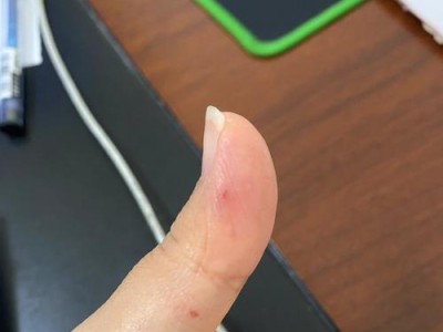 猫咪必打疫苗，守护它们的健康（保护猫咪免受疾病侵袭的关键一步）