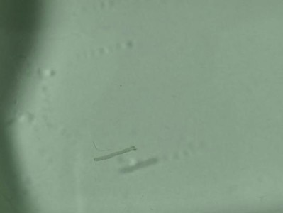 揭秘猫肚子里的白色虫子（探索猫体内寄生的神秘生物，白色虫子）