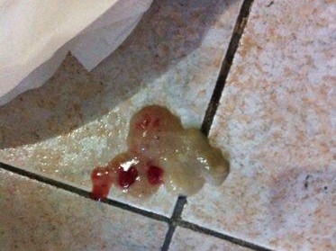 狗狗拉稀带血（了解拉稀带血的原因和治疗方式，为宠物狗的健康保驾护航）