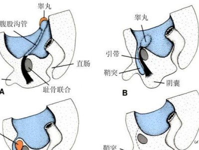 关于狗狗隐睾手术的必要性（探究隐睾症状、手术方法及注意事项）